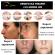 Masca Faciala cu LED 7 Culori, Tratament Curent Galvanic pentru Ten, Acnee, Pete, Riduri, Ingrijire si Intretinerea Pielii pentru Fata si Gat