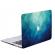 Carcasa Macbook 13