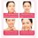 Aparat Cosmetic 5in1 Foton cu Ultrasunete Masaj Facial, Lifting, Ingrijirea pielii, Indepartarea ridurilor, Curatare Ten, Anti-Acnee, Alb