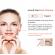 Aparat Cosmetic Skin Scrubber, Peeling Exfoliator Facial, Multi-Functional Face Lifting Beauty Machine, Peach, Perfect