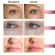 Dispozitiv Premium Reglabil, pentru Aplicarea Acidului Hialuronic fara Ac, Hyaluron Pen, Metalic, pentru Lifting, Volumizarea, Marirea Buzelor si Umplerea Ridurilor, Fiole de 0.3ml si 0.5ml, Capete de 0.3 mm si 0.5mm, Inalta Presiune, Gold